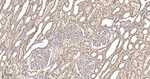 SHC Antibody in Immunohistochemistry (Paraffin) (IHC (P))
