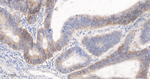 CD166 Antibody in Immunohistochemistry (Paraffin) (IHC (P))