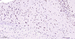TRPM7 Antibody in Immunohistochemistry (Paraffin) (IHC (P))