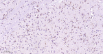 TRPM7 Antibody in Immunohistochemistry (Paraffin) (IHC (P))