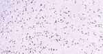 TRPM7 Antibody in Immunohistochemistry (Paraffin) (IHC (P))