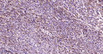TRPM7 Antibody in Immunohistochemistry (Paraffin) (IHC (P))