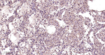TRPM7 Recombinant Rabbit Monoclonal Antibody (3E3)