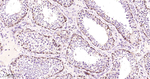TFAM Antibody in Immunohistochemistry (Paraffin) (IHC (P))