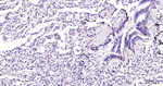 EGR1 Antibody in Immunohistochemistry (Paraffin) (IHC (P))