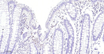 ZEB1 Antibody in Immunohistochemistry (Paraffin) (IHC (P))