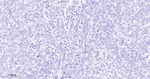 ZEB1 Recombinant Rabbit Monoclonal Antibody (4C1)