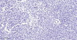 ZEB1 Antibody in Immunohistochemistry (Paraffin) (IHC (P))