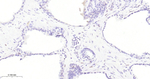 ZEB1 Antibody in Immunohistochemistry (Paraffin) (IHC (P))