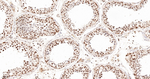 Cullin 1 Antibody in Immunohistochemistry (Paraffin) (IHC (P))