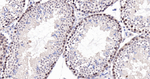 Cullin 1 Antibody in Immunohistochemistry (Paraffin) (IHC (P))