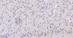 Metadherin Antibody in Immunohistochemistry (Paraffin) (IHC (P))