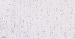 Metadherin Recombinant Rabbit Monoclonal Antibody (2G12)