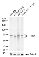 Metadherin Antibody in Western Blot (WB)
