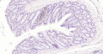PFKFB3 Antibody in Immunohistochemistry (Paraffin) (IHC (P))