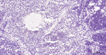 PFKFB3 Antibody in Immunohistochemistry (Paraffin) (IHC (P))