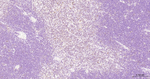 PFKFB3 Antibody in Immunohistochemistry (Paraffin) (IHC (P))
