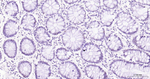 PFKFB3 Antibody in Immunohistochemistry (Paraffin) (IHC (P))