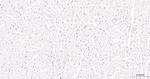 PFKFB3 Antibody in Immunohistochemistry (Paraffin) (IHC (P))
