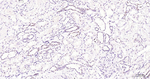 PFKFB3 Antibody in Immunohistochemistry (Paraffin) (IHC (P))