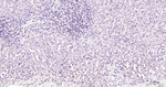 PFKFB3 Antibody in Immunohistochemistry (Paraffin) (IHC (P))