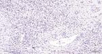 PFKFB3 Recombinant Rabbit Monoclonal Antibody (3F10)