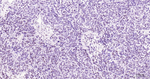 PFKFB3 Antibody in Immunohistochemistry (Paraffin) (IHC (P))
