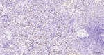 PFKFB3 Antibody in Immunohistochemistry (Paraffin) (IHC (P))