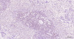 PFKFB3 Antibody in Immunohistochemistry (Paraffin) (IHC (P))