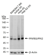 PFKFB3 Antibody in Western Blot (WB)