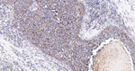 PDK2 Antibody in Immunohistochemistry (Paraffin) (IHC (P))