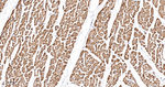 PDK2 Antibody in Immunohistochemistry (Paraffin) (IHC (P))