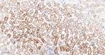 PDK2 Antibody in Immunohistochemistry (Paraffin) (IHC (P))