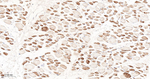PDK2 Antibody in Immunohistochemistry (Paraffin) (IHC (P))