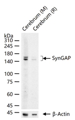 SynGAP Recombinant Rabbit Monoclonal Antibody (1E10)