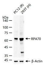 RPA70 Antibody in Western Blot (WB)