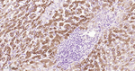CRP Antibody in Immunohistochemistry (Paraffin) (IHC (P))