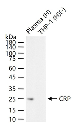 CRP Antibody in Western Blot (WB)