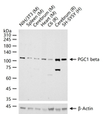 PPARGC1B Recombinant Rabbit Monoclonal Antibody (19E18)