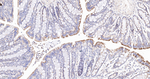 PDHB Antibody in Immunohistochemistry (Paraffin) (IHC (P))
