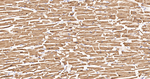 PDHB Antibody in Immunohistochemistry (Paraffin) (IHC (P))