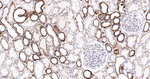 PDHB Antibody in Immunohistochemistry (Paraffin) (IHC (P))