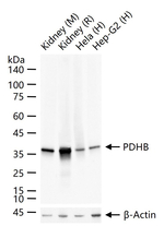 PDHB Antibody in Western Blot (WB)