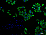 RRM2 Recombinant Rabbit Monoclonal Antibody (7H9)