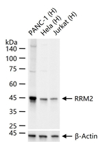 RRM2 Antibody in Western Blot (WB)