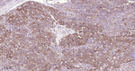 MVP Recombinant Rabbit Monoclonal Antibody (11G10)