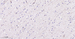 MVP Antibody in Immunohistochemistry (Paraffin) (IHC (P))
