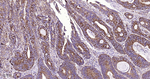 MVP Antibody in Immunohistochemistry (Paraffin) (IHC (P))
