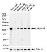MVP Antibody in Western Blot (WB)