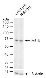 MELK Recombinant Rabbit Monoclonal Antibody (7A9)